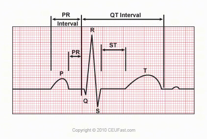 Intervals