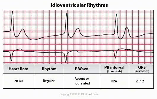 EKG, ECG Interpretation Course | CEUfast Nursing Continuing Education