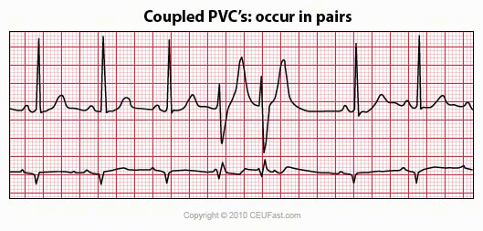 coupled pvc