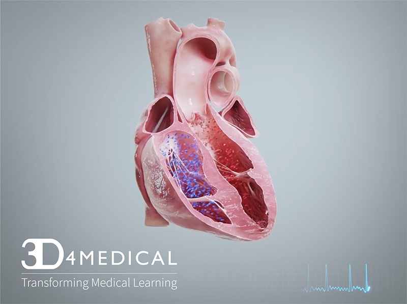 3d4medical heart