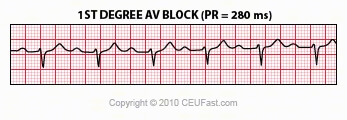 CEUFast - ECG Interpretation