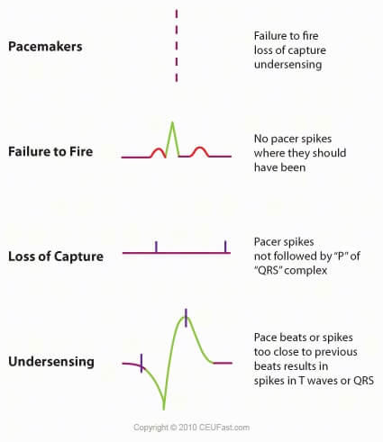 Ekg Ecg Interpretation Course Ceufast Nursing Continuing Education