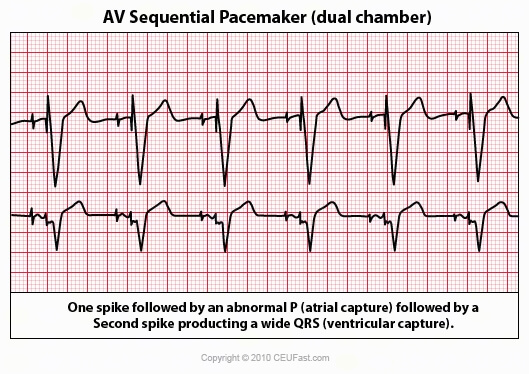 EKG, ECG Interpretation Course | CEUfast Nursing Continuing Education