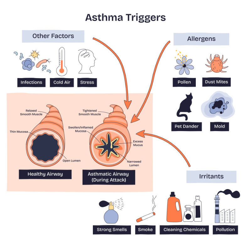 graphic showing asthma triggers