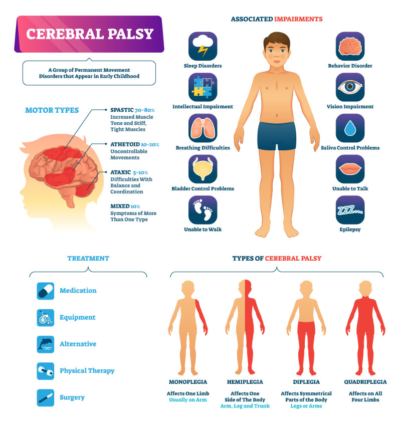 graphic showing cerebral palsy