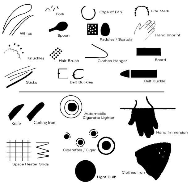 graphic showing clues to the mechanism of injury