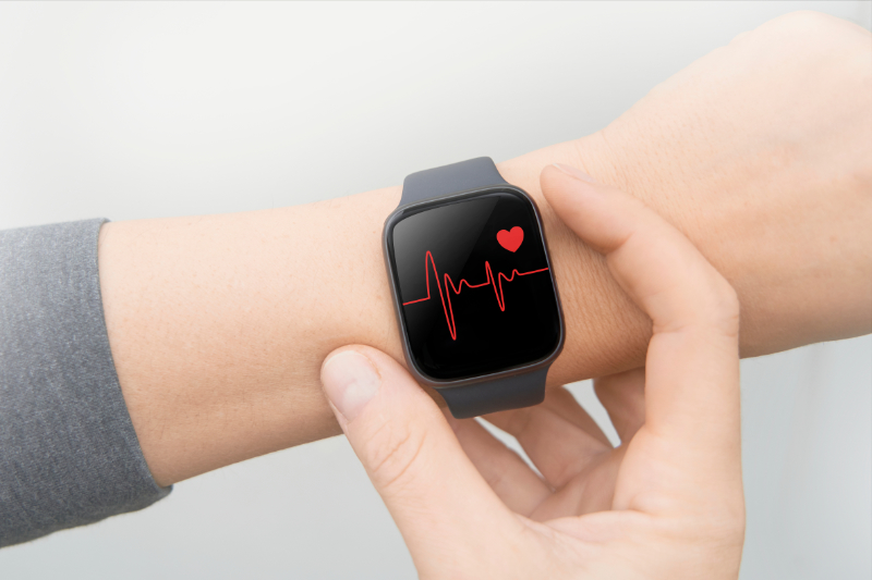 photo of ecg on a smartwatch