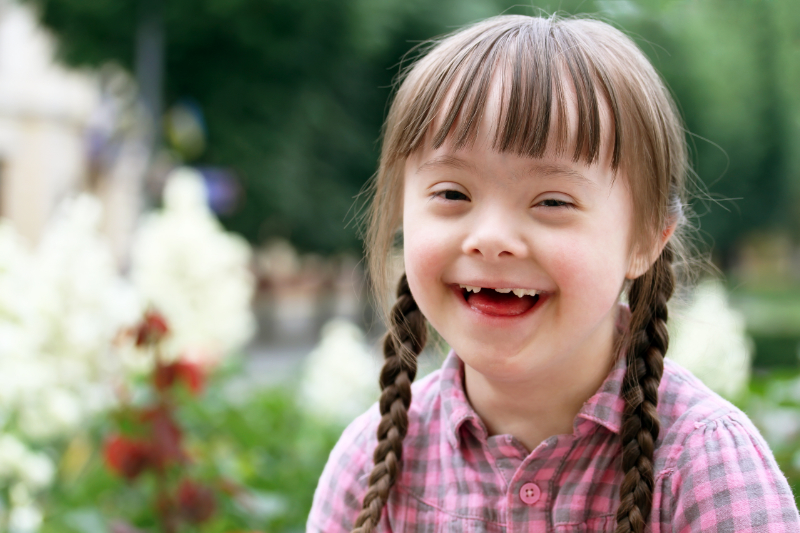 photo of child with down syndrome