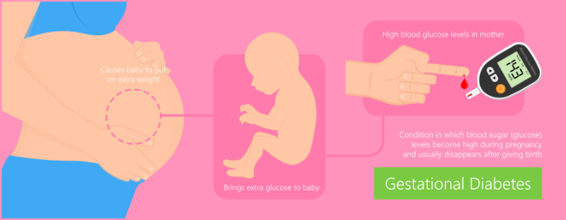 graphic showing gestational diabetes