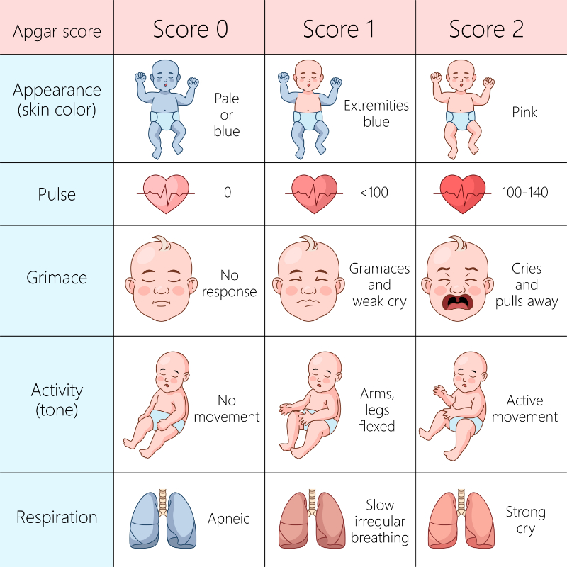 graphic showing apgar scoring