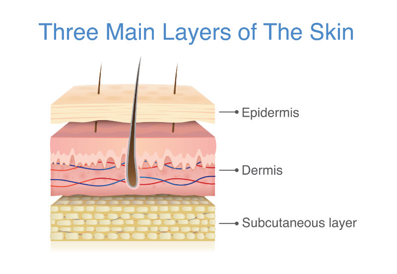 graphic showing the three main layers of the skin