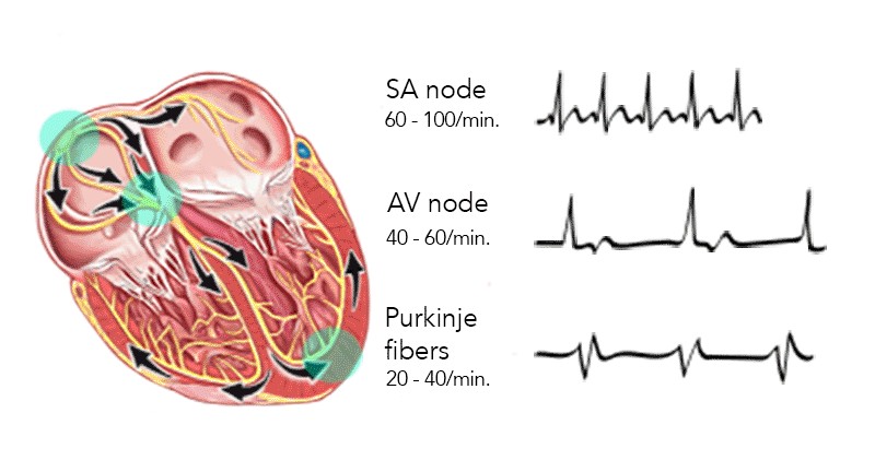 graphic of basic cardiac rhythms