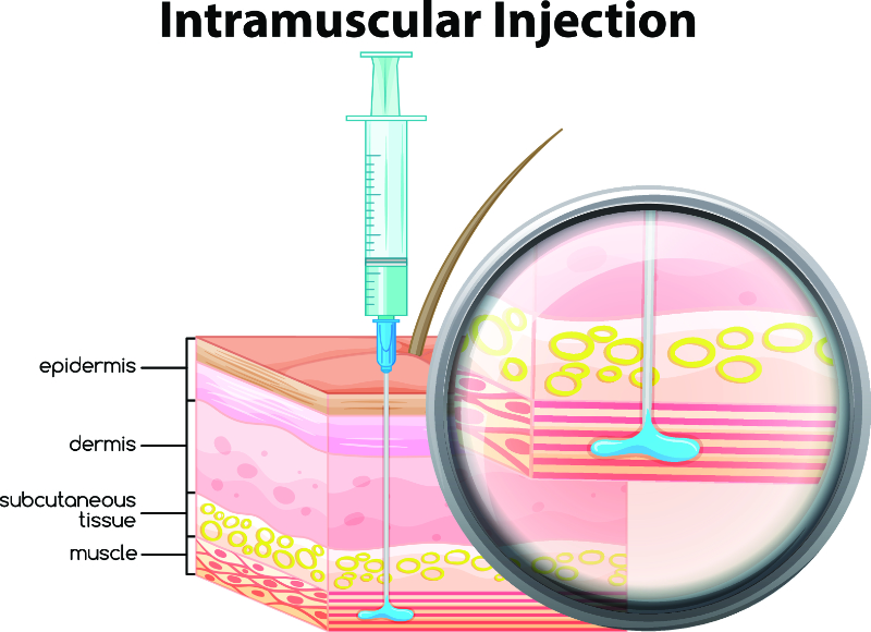 graphic showing intramuscular injection