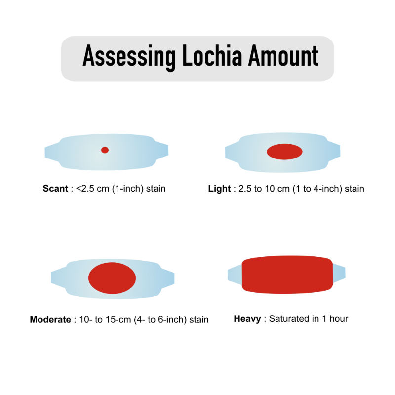 graphic showing assessment lochia amounts