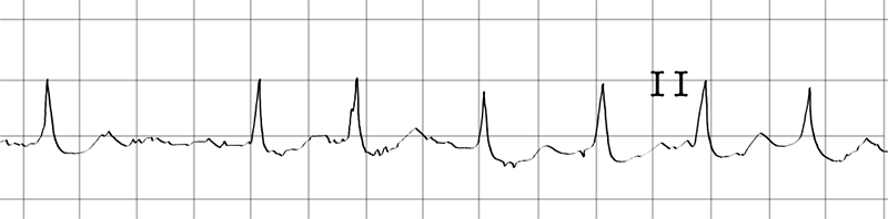 image of ekg-ecg