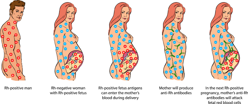 graphic showing rh incompatibility