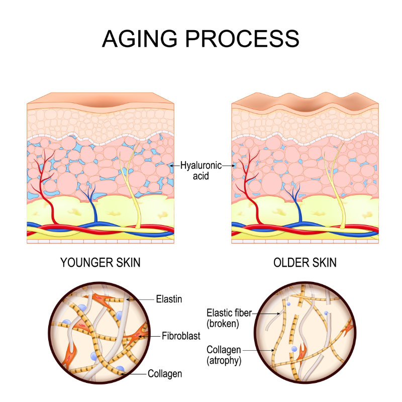graphic showing stages of aging skin