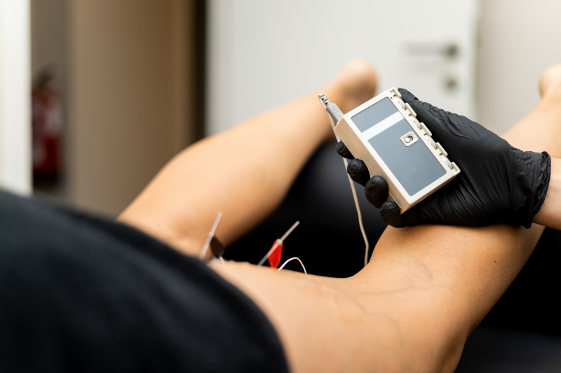 photo of electrical stimulation with needling