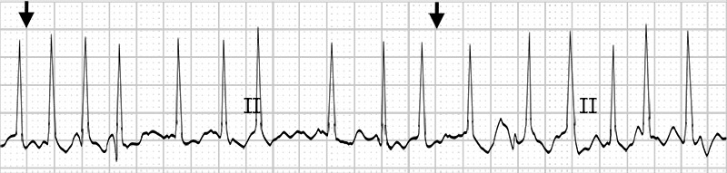 graphic of ekg