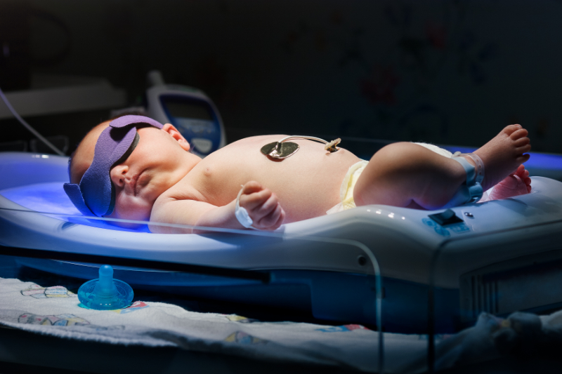 photo of infant with eye protection for phototherapy