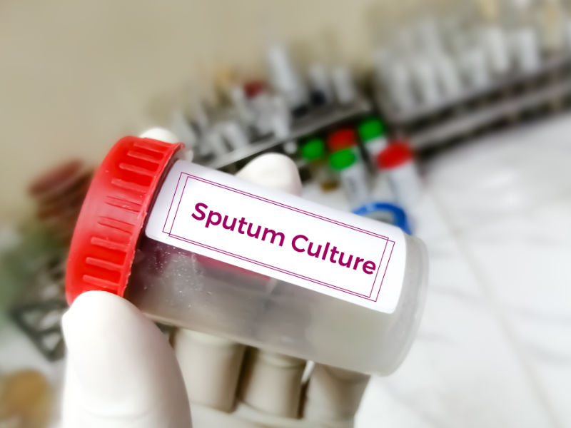 photo of sputum culture sample container