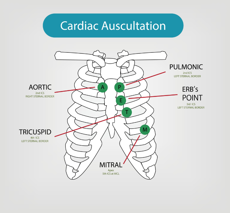 graphic showing cardiac auscultation sites