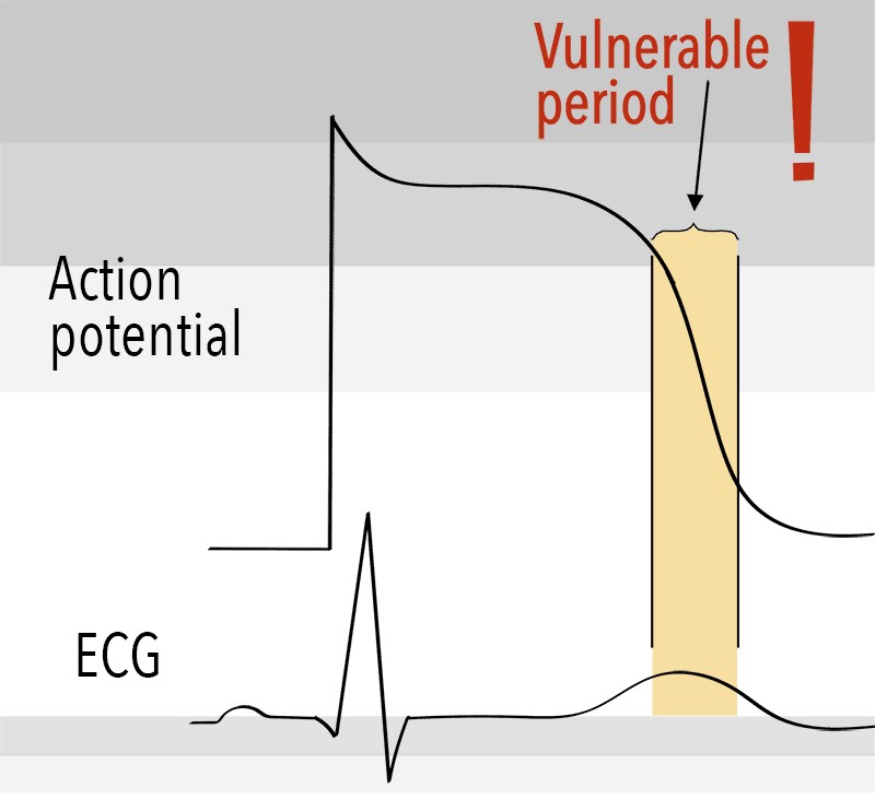 graphic showing t wave maximum vulnerability