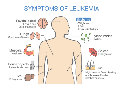 leukemia_symptoms