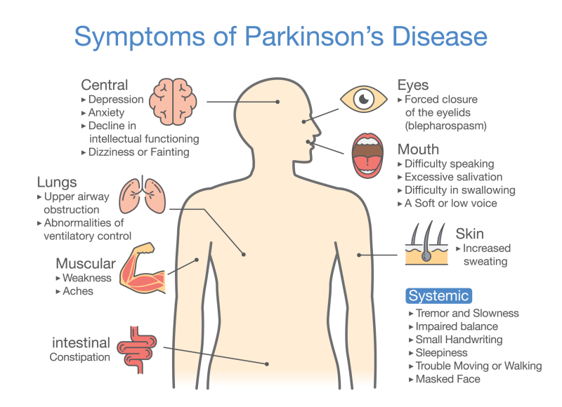 Parkinson s Disease And Treatment Of Muscle