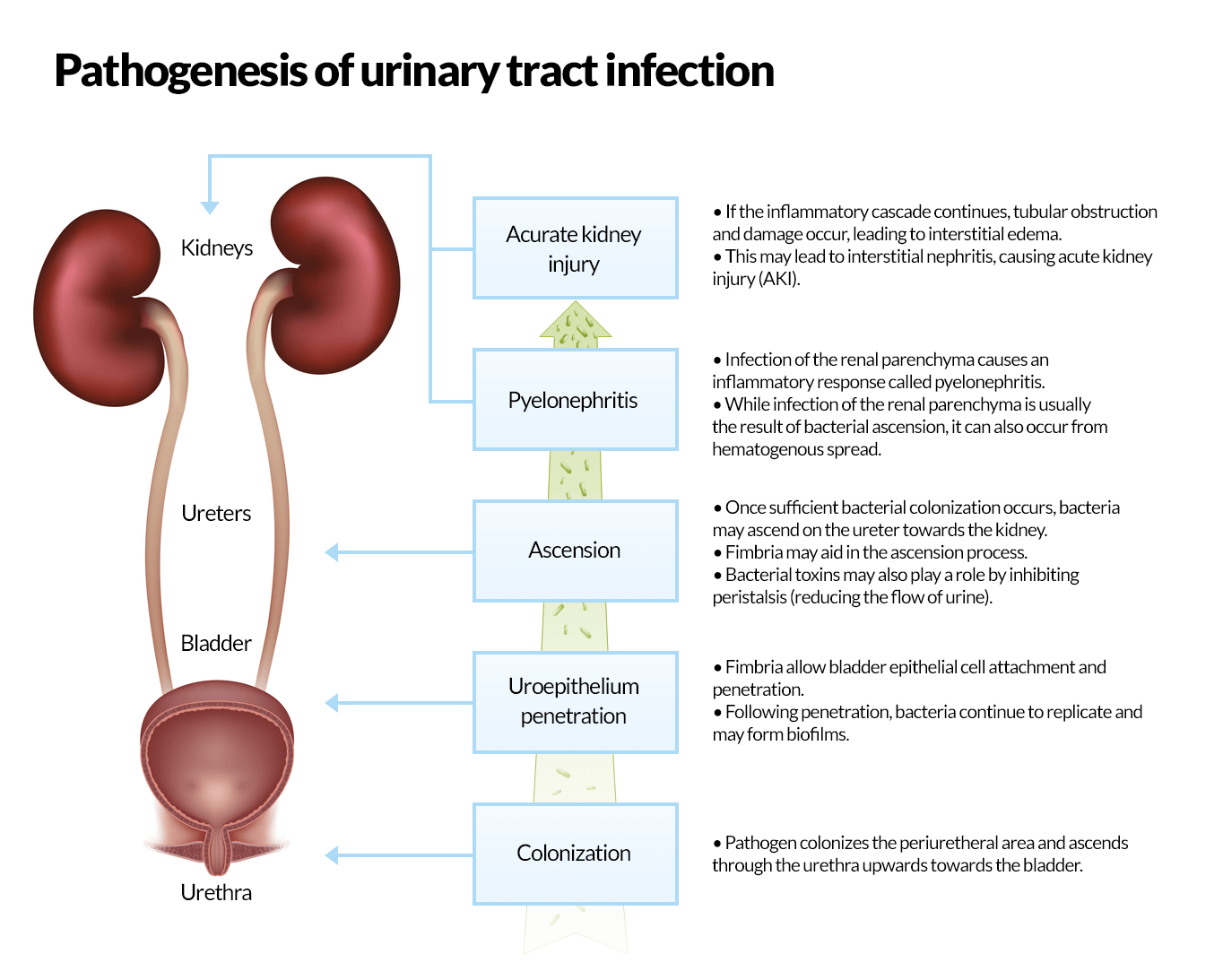 free-vector-informative-illustration-of-urinary-tract-infections