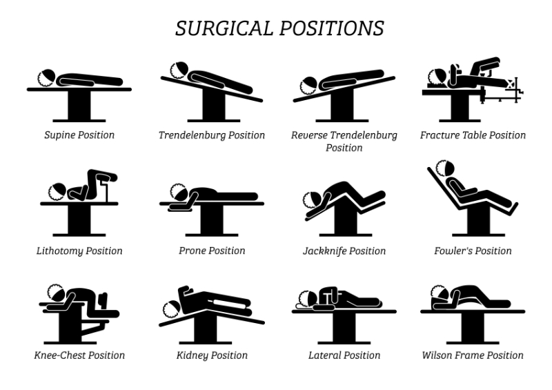 graphic showing different surgical positions