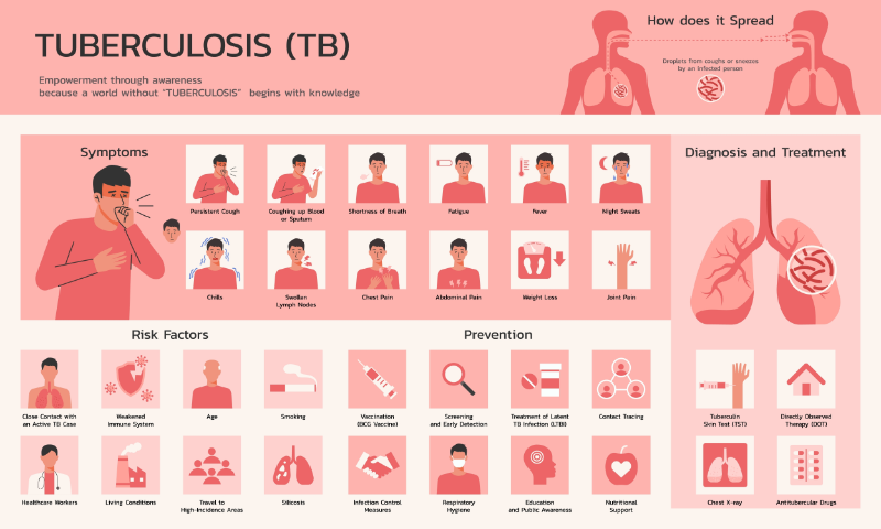 tuberculosis infographic